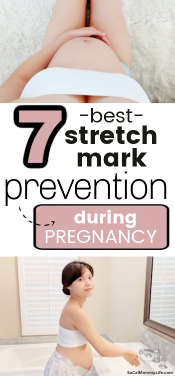stretch mark prevention pregnancy
