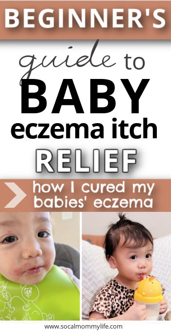 baby eczema itch relief