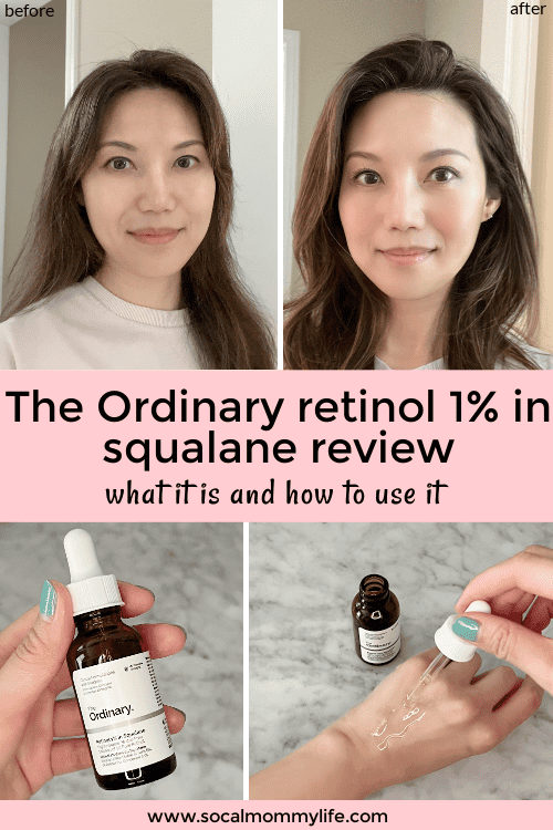 the ordinary retinol 1% in squalane review
